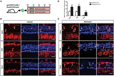 Characterization of Lgr5+ Progenitor Cell Transcriptomes after Neomycin Injury in the Neonatal Mouse Cochlea